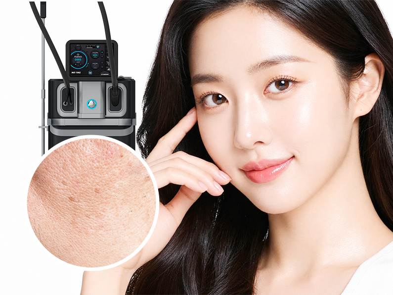 악센토 탄력 피부결