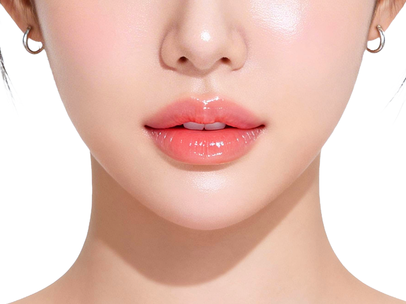 입술 입가 볼륨필러