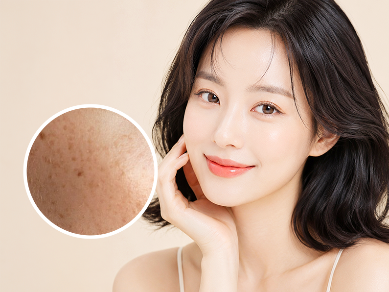 색소 패키지